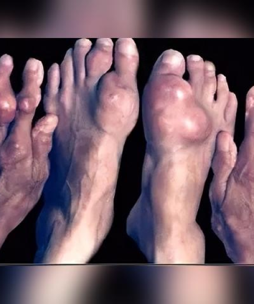 瘦身药排名前十名，科学有效助你轻松瘦身